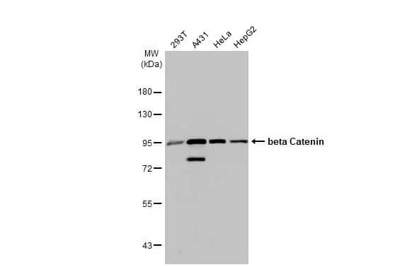 Western Blot: beta-Catenin Antibody (GT2169) [NBP3-13530] - Various whole cell extracts (30 ug) were separated by 7.5% SDS-PAGE, and the membrane was blotted with beta-Catenin antibody [GT2169] (NBP3-13530) diluted at 1:1000. The HRP-conjugated anti-mouse IgG antibody  was used to detect the primary antibody.