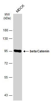 Western Blot: beta-Catenin Antibody (GT2169) [NBP3-13530] - Whole cell extract (30 ug) was separated by 7.5% SDS-PAGE, and the membrane was blotted with beta-Catenin antibody (NBP3-13530) diluted at 1:500. The HRP-conjugated anti-mouse IgG antibody  was used to detect the primary antibody, and the signal was developed with Trident ECL plus-Enhanced.