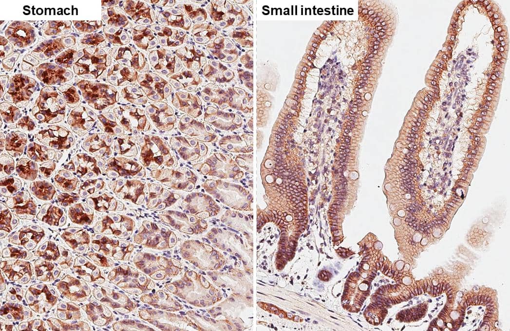 beta Catenin antibody [GT2169] detects beta Catenin protein by immunohistochemical analysis.Sample: Paraffin-embedded mouse tissues.beta Catenin stained by beta Catenin antibody [GT2169] (NBP3-13530) diluted at 1:500.Antigen Retrieval: Citrate buffer, pH 6.0, 15 min 