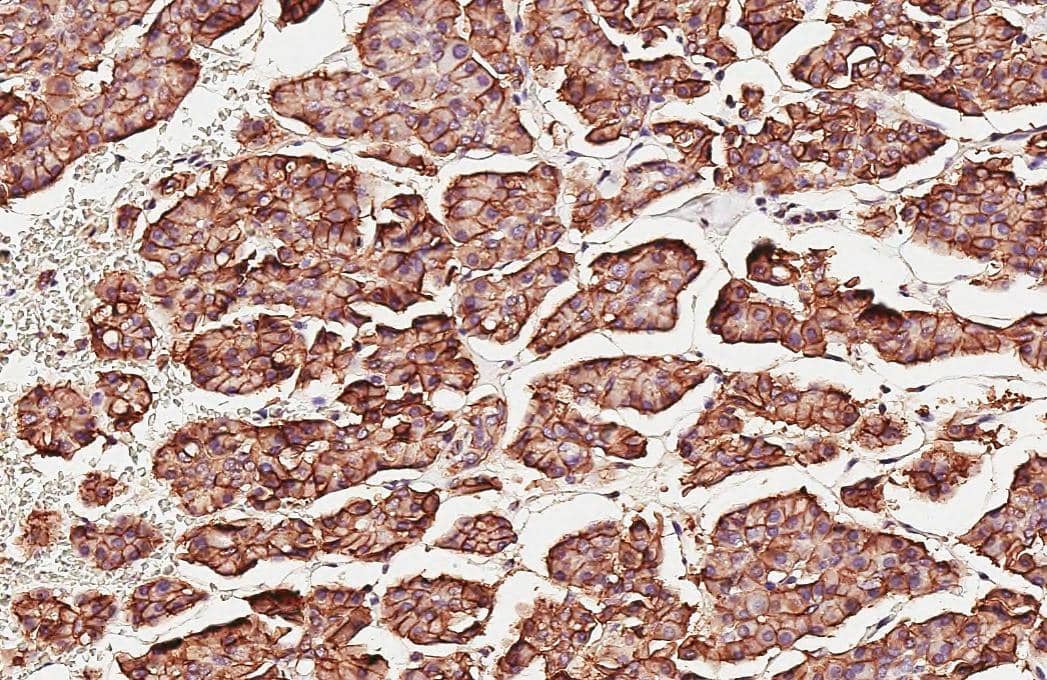 beta Catenin antibody [GT2169] detects beta Catenin protein by immunohistochemical analysis.Sample: Paraffin-embedded human pancreas.beta Catenin stained by beta Catenin antibody [GT2169] (NBP3-13530) diluted at 1:500.Antigen Retrieval: Citrate buffer, pH 6.0, 15 min 