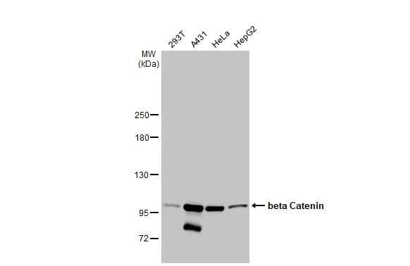 Various whole cell extracts (30 ug) were separated by 5% SDS-PAGE, and the membrane was blotted with beta Catenin antibody [GT2169] (NBP3-13530) diluted at 1:1000. The HRP-conjugated anti-mouse IgG antibody  was used to detect the primary antibody, and the signal was developed with Trident ECL plus-Enhanced. 