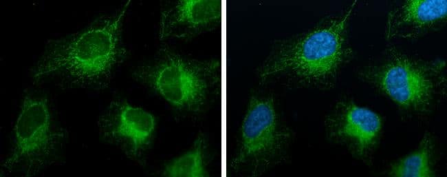FACL4 antibody [GT186] detects FACL4 protein at mitochondria by immunofluorescent analysis.Sample: HeLa cells were fixed in ice-cold MeOH for 5 min.Green: FACL4 stained by FACL4 antibody [GT186] (NBP3-13533) diluted at 1:100.Blue: Hoechst 33342 staining. 