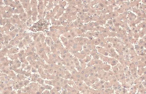 Immunohistochemistry-Paraffin: ATP6V1A Antibody (GT811) [NBP3-13541] - ATP6V1A antibody [GT811] detects ATP6V1A protein at cytoplasm by immunohistochemical analysis.Sample: Paraffin-embedded rat liver.ATP6V1A stained by ATP6V1A antibody [GT811] (NBP3-13541) diluted at 1:200.Antigen Retrieval: Citrate buffer, pH 6.0, 15 min