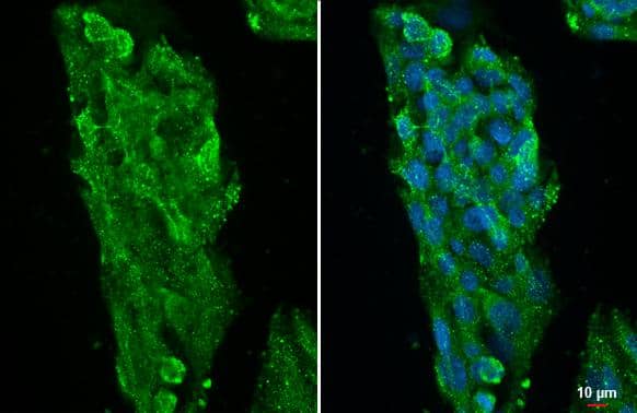 ATP6V1A antibody [GT811] detects ATP6V1A protein at cytoplasm by immunofluorescent analysis.Sample: HepG2 cells were fixed in 4% paraformaldehyde at RT for 15 min.Green: ATP6V1A stained by ATP6V1A antibody [GT811] (NBP3-13541) diluted at 1:500.Blue: Fluoroshield with DAPI . 