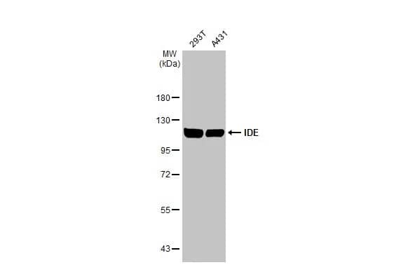 Western Blot: Insulysin/IDE Antibody (GT286) [NBP3-13547] - Various whole cell extracts (30 ug) were separated by 7.5% SDS-PAGE, and the membrane was blotted with Insulysin/IDE antibody [GT286] (NBP3-13547) diluted at 1:1000. The HRP-conjugated anti-mouse IgG antibody  was used to detect the primary antibody.