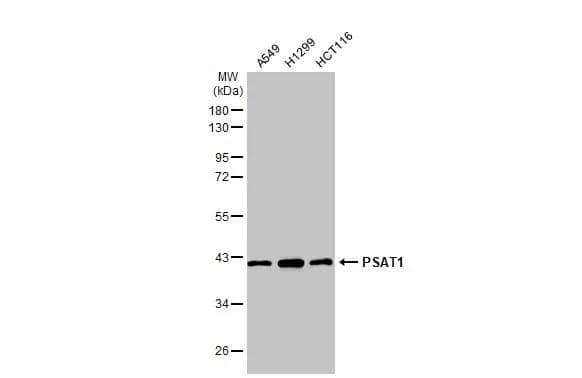 Various whole cell extracts (30 ug) were separated by 10% SDS-PAGE, and the membrane was blotted with PSAT1 antibody [GT1353] (NBP3-13548) diluted at 1:1000. The HRP-conjugated anti-mouse IgG antibody  was used to detect the primary antibody. 