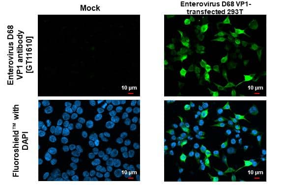 Enterovirus D68 VP1 antibody [GT11610] detects Enterovirus D68 VP1 protein by immunofluorescent analysis.Sample: Mock and transfected 293T cells were fixed in 4% paraformaldehyde at RT for 15 min.Green: Enterovirus D68 VP1 stained by Enterovirus D68 VP1 antibody [GT11610] (NBP3-13557) diluted at 1:500.Blue: Fluoroshield with DAPI . 
