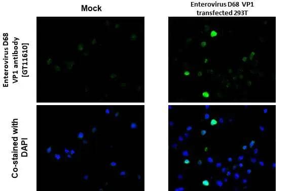 Enterovirus D68 VP1 antibody [GT11610] detects Enterovirus D68 VP1 protein by immunohistochemical analysis.Sample: Paraffin-embedded mock and Enterovirus D68 VP1 transfected 293T cell.Green: Enterovirus D68 VP1 stained by Enterovirus D68 VP1 antibody [GT11610] (NBP3-13557) diluted at 1:4000.Blue: Fluoroshield with DAPI .Antigen Retrieval: Citrate buffer, pH 6.0, 15 min 