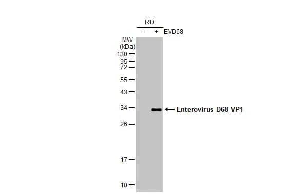Non-infected (-) and infected (+) RD whole cell extracts (5 ug) were separated by 12% SDS-PAGE, and the membrane was blotted with Enterovirus D68 VP1 antibody [GT11610] (NBP3-13557) diluted at 1:1000. The HRP-conjugated anti-mouse IgG antibody  was used to detect the primary antibody. 