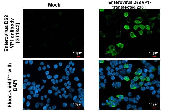 Enterovirus D68 VP1 antibody [GT1843] detects Enterovirus D68 VP1 protein by immunofluorescent analysis.Sample: Mock and transfected 293T cells were fixed in 4% paraformaldehyde at RT for 15 min.Green: Enterovirus D68 VP1 stained by Enterovirus D68 VP1 antibody [GT1843] (NBP3-13564) diluted at 1:500.Blue: Fluoroshield with DAPI . 