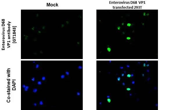 Enterovirus D68 VP1 antibody [GT1843] detects Enterovirus D68 VP1 protein by immunohistochemical analysis.Sample: Paraffin-embedded mock and Enterovirus D68 VP1 transfected 293T cell.Green: Enterovirus D68 VP1 stained by Enterovirus D68 VP1 antibody [GT1843] (NBP3-13564) diluted at 1:4000.Blue: Fluoroshield with DAPI .Antigen Retrieval: Citrate buffer, pH 6.0, 15 min 