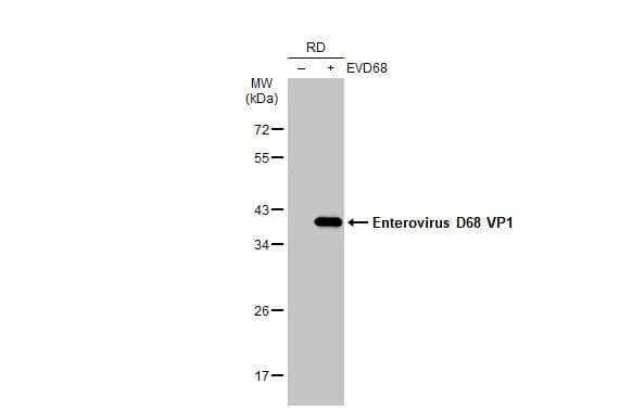 Non-infected (-) and infected (+) RD whole cell extracts (30 ug) were separated by 12% SDS-PAGE, and the membrane was blotted with Enterovirus D68 VP1 antibody [GT1843] (NBP3-13564) diluted at 1:1000. The HRP-conjugated anti-mouse IgG antibody  was used to detect the primary antibody. 