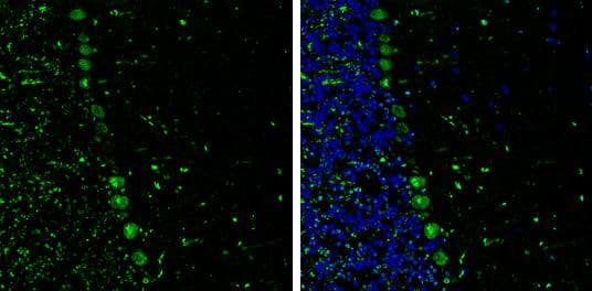 p130Cas antibody [GT331] detects p130Cas protein expression by immunohistochemical analysis.Sample: Frozen-sectioned adult mouse cerebellum. Green: p130Cas protein stained by p130Cas antibody [GT331] (NBP3-13565) diluted at 1:250.Blue: Fluoroshield with DAPI . Antigen Retrieval: Citrate buffer, pH 6.0, 10 min 
