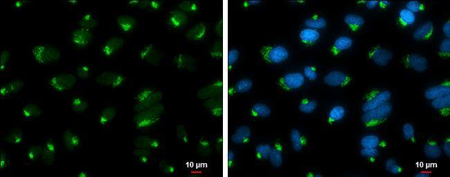GOLGA5 antibody [GT2726] detects GOLGA5 protein at Golgi apparatus by immunofluorescent analysis.Sample: A549 cells were fixed in 4% paraformaldehyde at RT for 15 min.Green: GOLGA5 protein stained by GOLGA5 antibody [GT2726] (NBP3-13566) diluted at 1:500.Blue: Hoechst 33342 staining.Scale bar = 10 um. 