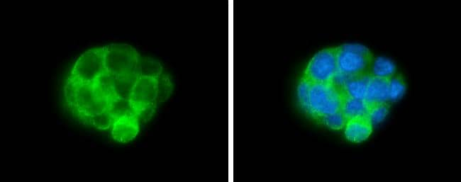 ALDH1A3 antibody [GT926] detects ALDH1A3 protein at cytoplasm by immunofluorescent analysis.Sample: Hep G2 cells were fixed in 4% paraformaldehyde at RT for 15 min.Green: ALDH1A3 protein stained by ALDH1A3 antibody [GT926] (NBP3-13570) diluted at 1:500.Blue: Hoechst 33342 staining. 
