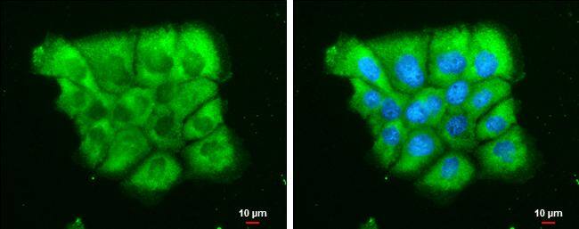 Dicer antibody [GT1176] detects Dicer protein at cytoplasm by immunofluorescent analysis.Sample: A431 cells were fixed in 4% paraformaldehyde at RT for 15 min.Green: Dicer stained by Dicer antibody [GT1176] (NBP3-13572) diluted at 1:500.Blue: Hoechst 33342 staining.Scale bar= 10um. 