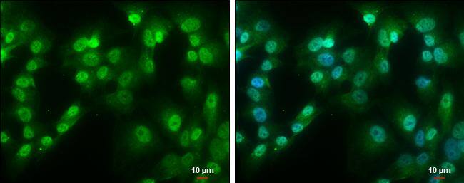 QKI antibody [GT1589] detects QKI protein at cytoplasm and nucleus by immunofluorescent analysis.Sample: SK-N-AS cells were fixed in 4% paraformaldehyde at RT for 15 min.Green: QKI protein stained by QKI antibody [GT1589] (NBP3-13575) diluted at 1:500.Blue: Hoechst 33342 staining.Scale bar = 10 um. 