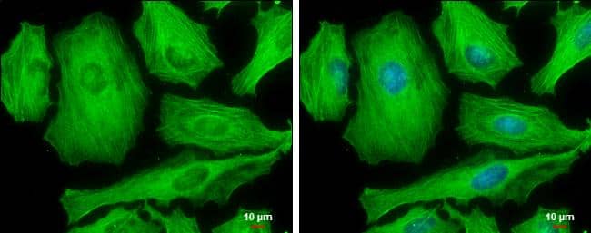MYH9 (phospho Ser1943) antibody [GT144] detects MYH9 (phospho Ser1943) protein at cytoskeleton by immunofluorescent analysis.Sample: HeLa cells were fixed in ice-cold MeOH for 5 min.Green: MYH9 (phospho Ser1943) protein stained by MYH9 (phospho Ser1943) antibody [GT144] (NBP3-13579) diluted at 1:500.Blue: Hoechst 33342 staining.Scale bar = 10 um. 