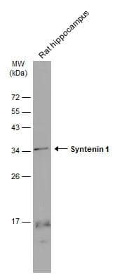 Rat tissue extract (50 ug) was separated by 12% SDS-PAGE, and the membrane was blotted with Syntenin 1 antibody [GT1523] (NBP3-13586) diluted at 1:1000. The HRP-conjugated anti-mouse IgG antibody  was used to detect the primary antibody, and the signal was developed with Trident ECL plus-Enhanced. 
