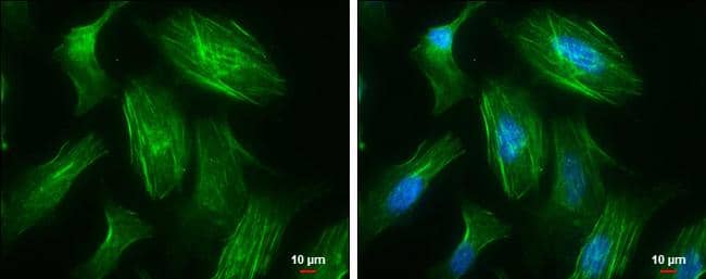 MYH10 antibody [GT246] detects MYH10 protein at cytoskeleton by immunofluorescent analysis.Sample: HeLa cells were fixed in 4% paraformaldehyde at RT for 15 min.Green: MYH10 protein stained by MYH10 antibody [GT246] (NBP3-13591) diluted at 1:500.Blue: Hoechst 33342 staining.Scale bar = 10 um. 