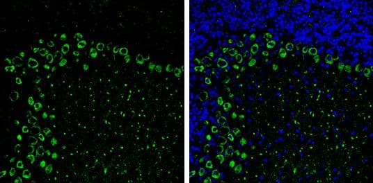 MYH10 antibody [GT246] detects MYH10 Protein expression by immunohistochemical analysis.Sample: Frozen-sectioned adult mouse cerebellum. Green: MYH10 stained by MYH10 antibody [GT246] (NBP3-13591) diluted at 1:250.Blue: Fluoroshield with DAPI . Antigen Retrieval: Citrate buffer, pH 6.0, 10 min 