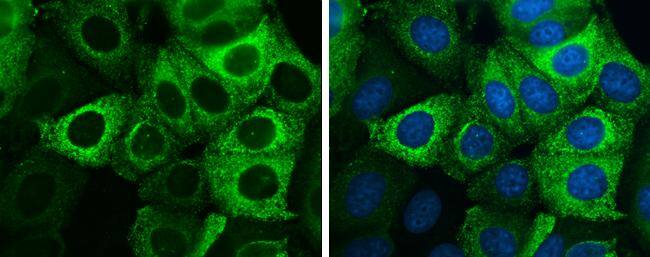 Anterior Gradient 2 antibody [GT5812] detects Anterior Gradient 2 protein at endoplasmic reticulum by immunofluorescent analysis.Sample: MCF-7 cells were fixed in 4% paraformaldehyde at RT for 15 min.Green: Anterior Gradient 2 stained by Anterior Gradient 2 antibody [GT5812] (NBP3-13593) diluted at 1:500.Blue: Hoechst 33342 staining. 