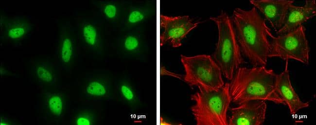 Cullin 4a antibody [GT885] detects Cullin 4a protein at nucleus by immunofluorescent analysis.Sample: HeLa cells were fixed in 4% paraformaldehyde at RT for 15 min.Green: Cullin 4a protein stained by Cullin 4a antibody [GT885] (NBP3-13594) diluted at 1:200.Red: Phalloidin, a cytoskeleton marker, diluted at 1:100.Scale bar = 10 um. 