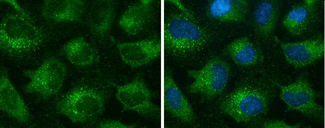 EEA1 antibody [GT10811] detects EEA1 protein at cytoplasm by immunofluorescent analysis.Sample: HeLa cells were fixed in 4% paraformaldehyde at RT for 15 min.Green: EEA1 stained by EEA1 antibody [GT10811] (NBP3-13599) diluted at 1:500.Blue: Hoechst 33342 staining. 