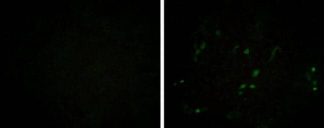 Porcine circovirus type 2 Capsid antibody [GT972] detects Porcine circovirus type 2 Capsid protein by immunofluorescent analysis.Sample: PCV2 non-infected (left) and infected (right) PK-15 cells were fixed in Acetone for 10 min.Green: Porcine circovirus type 2 Capsid protein stained by Porcine circovirus type 2 Capsid antibody [GT972] (NBP3-13604) diluted at 1:200. 