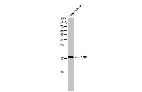 Western Blot: Atrial Natriuretic Peptide/ANP Antibody (GT1068) [NBP3-13605] - Mouse tissue extract (50 ug) was separated by 15% SDS-PAGE, and the membrane was blotted with Atrial Natriuretic Peptide/ANP antibody [GT1068] (NBP3-13605) diluted at 1:1000. The HRP-conjugated anti-mouse IgG antibody  was used to detect the primary antibody.