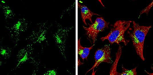 LAMP1 antibody [GT25212] detects LAMP1 protein at lysosome by immunofluorescent analysis.Sample: HeLa cells were fixed in ice-cold MeOH for 5 min.Green: LAMP1 stained by LAMP1 antibody [GT25212] (NBP3-13609) diluted at 1:2000.Red: alpha Tubulin 4a, a cytoskeleton marker, stained by alpha Tubulin 4a antibody  diluted at 1:500.Blue: Hoechst 33342 staining. 