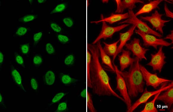 Immunocytochemistry/ Immunofluorescence: SP1 Antibody (GT2574) [NBP3-13611] - SP1 antibody [GT2574] detects SP1 protein at nucleus by immunofluorescent analysis.Sample: HeLa cells were fixed in 4% paraformaldehyde at RT for 15 min.Green: SP1 stained by SP1 antibody [GT2574] (NBP3-13611) diluted at 1:500.Red: beta Tubulin, a cytoskeleton marker, stained by beta Tubulin antibody  diluted at 1:1000.Scale bar= 10um.