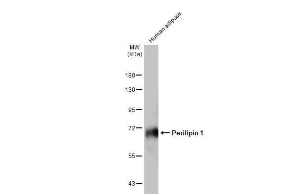 Human tissue extract (30 ug) was separated by 7.5% SDS-PAGE, and the membrane was blotted with Perilipin 1 antibody [GT2781] (NBP3-13615) diluted at 1:2000. The HRP-conjugated anti-mouse IgG antibody  was used to detect the primary antibody, and the signal was developed with Trident ECL plus-Enhanced. 