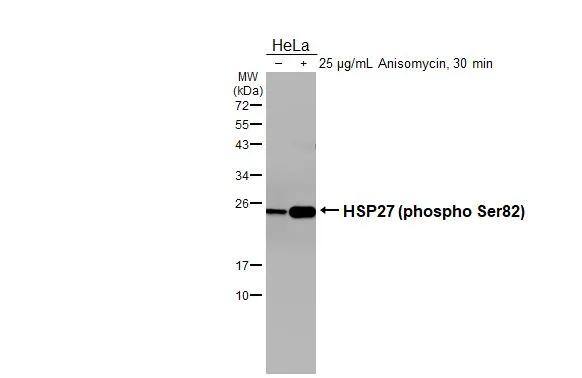 Untreated (-) and treated (+) HeLa whole cell extracts (30 ug) were separated by 12% SDS-PAGE, and the membrane was blotted with HSP27 (phospho Ser82) antibody [GT357] (NBP3-13617) diluted at 1:5000. The HRP-conjugated anti-mouse IgG antibody  was used to detect the primary antibody. 