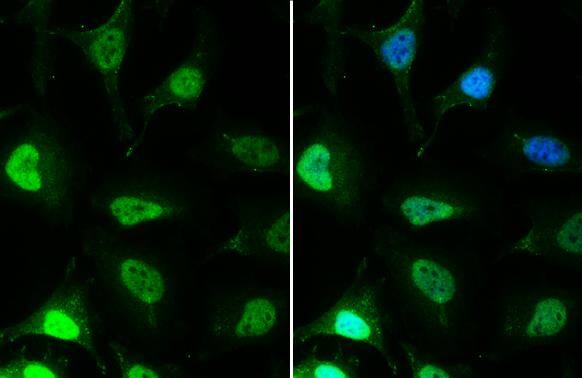 EED antibody [GT885] detects EED protein at nucleus by immunofluorescent analysis.Sample: HeLa cells were fixed in 4% paraformaldehyde at RT for 15 min.Green: EED stained by EED antibody [GT885] (NBP3-13628) diluted at 1:1000.Blue: Hoechst 33342 staining. 