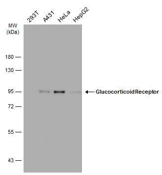 Various whole cell extracts (30 ug) were separated by 7.5% SDS-PAGE, and the membrane was blotted with Glucocorticoid Receptor antibody [GT1073] (NBP3-13630) diluted at 1:1000. The HRP-conjugated anti-mouse IgG antibody  was used to detect the primary antibody. 