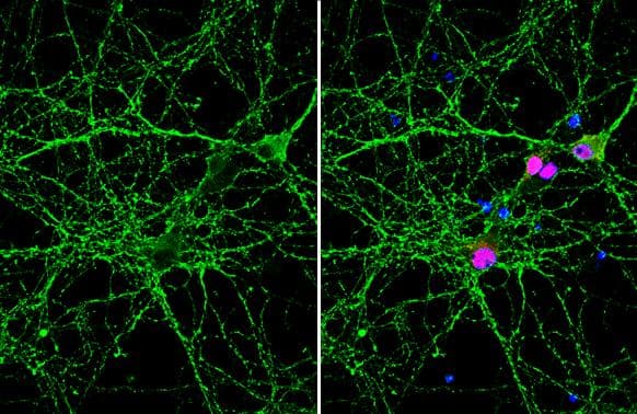 VAMP2 antibody [GT6311] detects VAMP2 protein by immunofluorescent analysis.Sample: DIV9 rat E18 primary hippocampal neuron cells were fixed in 4% paraformaldehyde at RT for 15 min.Green: VAMP2 stained by VAMP2 antibody [GT6311] (NBP3-13633) diluted at 1:500.Red: NeuN, stained by NeuN antibody  diluted at 1:1000.Blue: Fluoroshield with DAPI . 