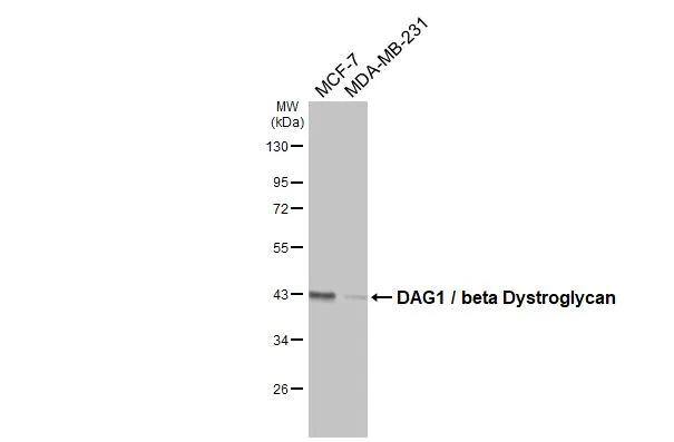 Various whole cell extracts (30 ug) were separated by 10% SDS-PAGE, and the membrane was blotted with DAG1 / beta Dystroglycan antibody [GT835] (NBP3-13643) diluted at 1:500. The HRP-conjugated anti-mouse IgG antibody  was used to detect the primary antibody. 