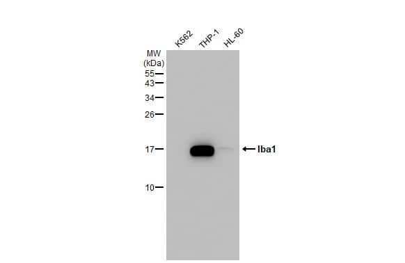 Western Blot: AIF-1/Iba1 Antibody (HL22) [NBP3-13648] - Various whole cell extracts (30 ug) were separated by 15% SDS-PAGE, and the membrane was blotted with AIF-1/Iba1 antibody [HL22] (NBP3-13648) diluted at 1:1000. The HRP-conjugated anti-rabbit IgG antibody  was used to detect the primary antibody.