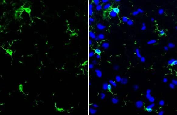 Iba1 antibody [HL22] detects Iba1 protein by immunohistochemical analysis.Sample: Paraffin-embedded rat brain.Iba1 stained by Iba1 antibody [HL22] (NBP3-13648) conjugated with DyLight488 diluted at 1:200.Blue: Fluoroshield with DAPI .Antigen Retrieval: Citrate buffer, pH 6.0, 15 min. 