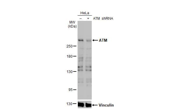 <b>Genetic Strategies Validation. </b>Western Blot: ATM Antibody (2C1-RB) [NBP3-13655] - Non-transfected (–) and transfected (+) HeLa whole cell extracts (30 ug) were separated by 5% SDS-PAGE, and the membrane was blotted with ATM antibody [2C1-RB]  diluted at 1:1000. The HRP-conjugated anti-rabbit IgG antibody  was used to detect the primary antibody.