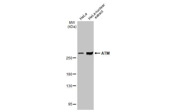 HeLa whole cell and nuclear extracts (30 ug) were separated by 5% SDS-PAGE, and the membrane was blotted with ATM antibody [2C1-RB] (NBP3-13655) diluted at 1:1000. The HRP-conjugated anti-rabbit IgG antibody  was used to detect the primary antibody. 