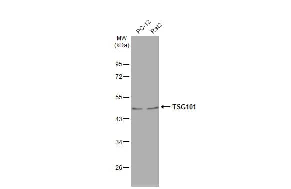 Western Blot: TSG101 Antibody (4A10-RB) [NBP3-13656] - Various whole cell extracts (30 ug) were separated by 10% SDS-PAGE, and the membrane was blotted with TSG101 antibody [4A10-RB] (NBP3-13656) diluted at 1:500. The HRP-conjugated anti-rabbit IgG antibody  was used to detect the primary antibody.