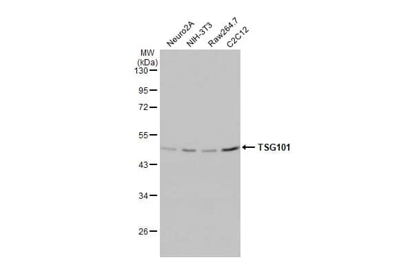 Western Blot: TSG101 Antibody (4A10-RB) [NBP3-13656] - Various whole cell extracts (30 ug) were separated by 10% SDS-PAGE, and the membrane was blotted with TSG101 antibody [4A10-RB] (NBP3-13656) diluted at 1:500. The HRP-conjugated anti-rabbit IgG antibody  was used to detect the primary antibody.