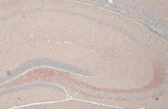 C9orf72 antibody [GT779-RB] detects C9orf72 protein at cytoplasm by immunohistochemical analysis.Sample: Paraffin-embedded mouse brain.C9orf72 stained by C9orf72 antibody [GT779-RB] (NBP3-13657) diluted at 1:100.Antigen Retrieval: Citrate buffer, pH 6.0, 15 min 