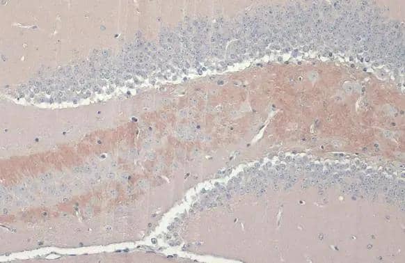 C9orf72 antibody [GT779-RB] detects C9orf72 protein at cytoplasm by immunohistochemical analysis.Sample: Paraffin-embedded mouse brain.C9orf72 stained by C9orf72 antibody [GT779-RB] (NBP3-13657) diluted at 1:100.Antigen Retrieval: Citrate buffer, pH 6.0, 15 min 