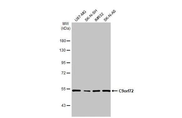 Various whole cell extracts (30 ug) were separated by 7.5% SDS-PAGE, and the membrane was blotted with C9orf72 antibody [GT779-RB] (NBP3-13657) diluted at 1:500. The HRP-conjugated anti-rabbit IgG antibody  was used to detect the primary antibody. 