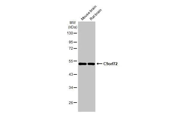 Various tissue extracts (50 ug) were separated by 10% SDS-PAGE, and the membrane was blotted with C9orf72 antibody [GT1553-RB] (NBP3-13658) diluted at 1:5000. The HRP-conjugated anti-rabbit IgG antibody  was used to detect the primary antibody. 