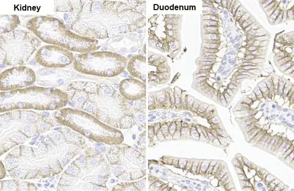 Immunohistochemistry-Paraffin: Sodium Potassium ATPase Alpha 1 Antibody (HL114) [NBP3-13660] - Sodium Potassium ATPase Alpha 1 antibody [HL114] detects Sodium Potassium ATPase Alpha 1 protein by immunohistochemical analysis.Sample: Paraffin-embedded mouse tissues.Sodium Potassium ATPase Alpha 1 stained by Sodium Potassium ATPase Alpha 1 antibody [HL114] (NBP3-13660) diluted at 1:100.Antigen Retrieval: Citrate buffer, pH 6.0, 15 min