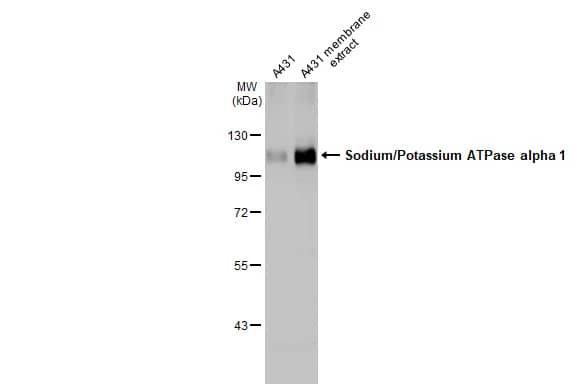 Western Blot: Sodium Potassium ATPase Alpha 1 Antibody (HL114) [NBP3-13660] - A431 whole cell and membrane extracts (30 ug) were separated by 7.5% SDS-PAGE, and the membrane was blotted with Sodium Potassium ATPase Alpha 1 antibody [HL114] (NBP3-13660) diluted at 1:500. The HRP-conjugated anti-rabbit IgG antibody  was used to detect the primary antibody.